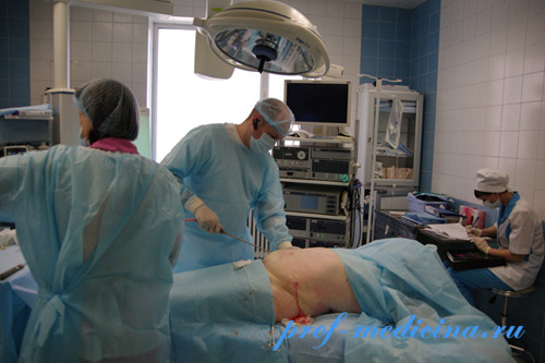 операция по удалению жира с живота цена операция по удалению жира с живота цена