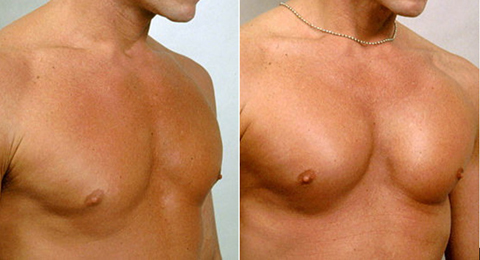bust salon spa цена в аптеке bust salon spa цена в аптеке