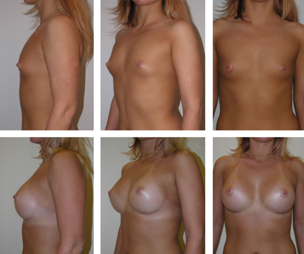 как у женщин появляется грудь (120) фото