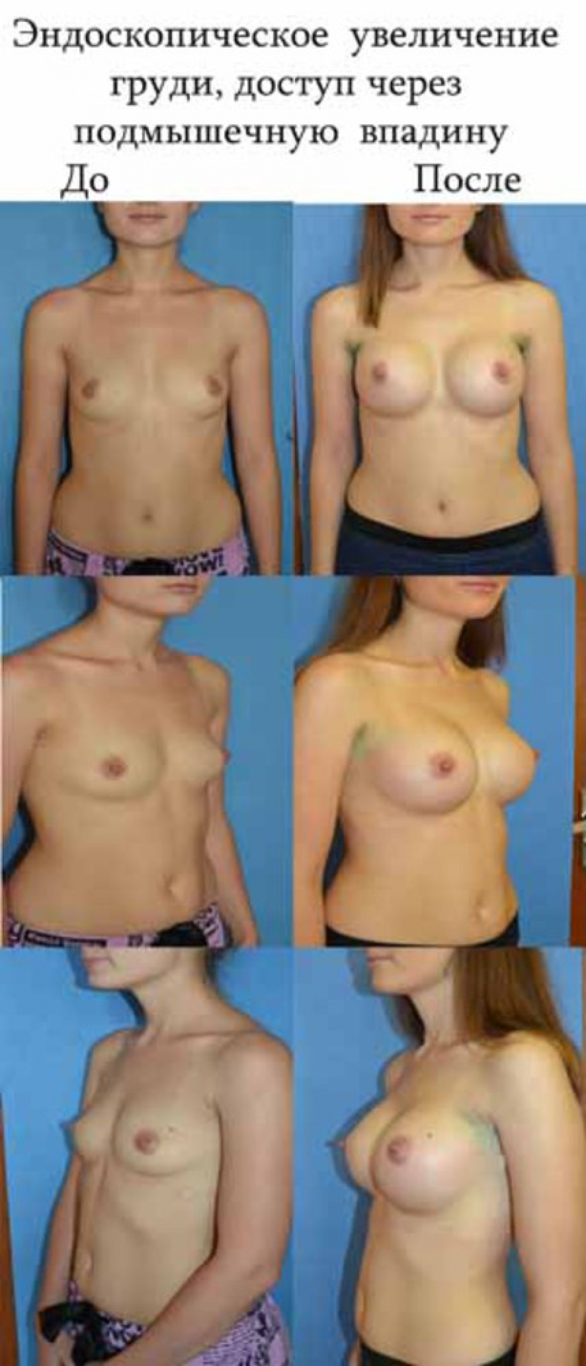 рост груди у женщин лице фото 1